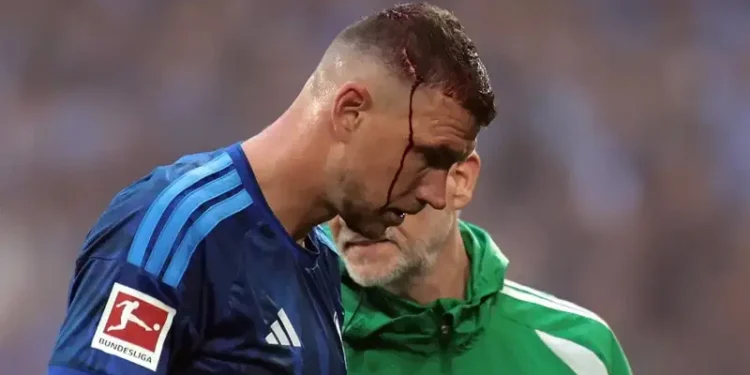 Edin Džeko krvave glave napustio teren: Povrijedio se u duelu, Schalke ostao bez bodova